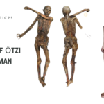 Secrets of Ötzi the Iceman